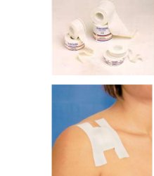 CEROTTO IN ROCCHETTO IN TELA EUROREEL MISURA 5X10 - Farmafamily.it